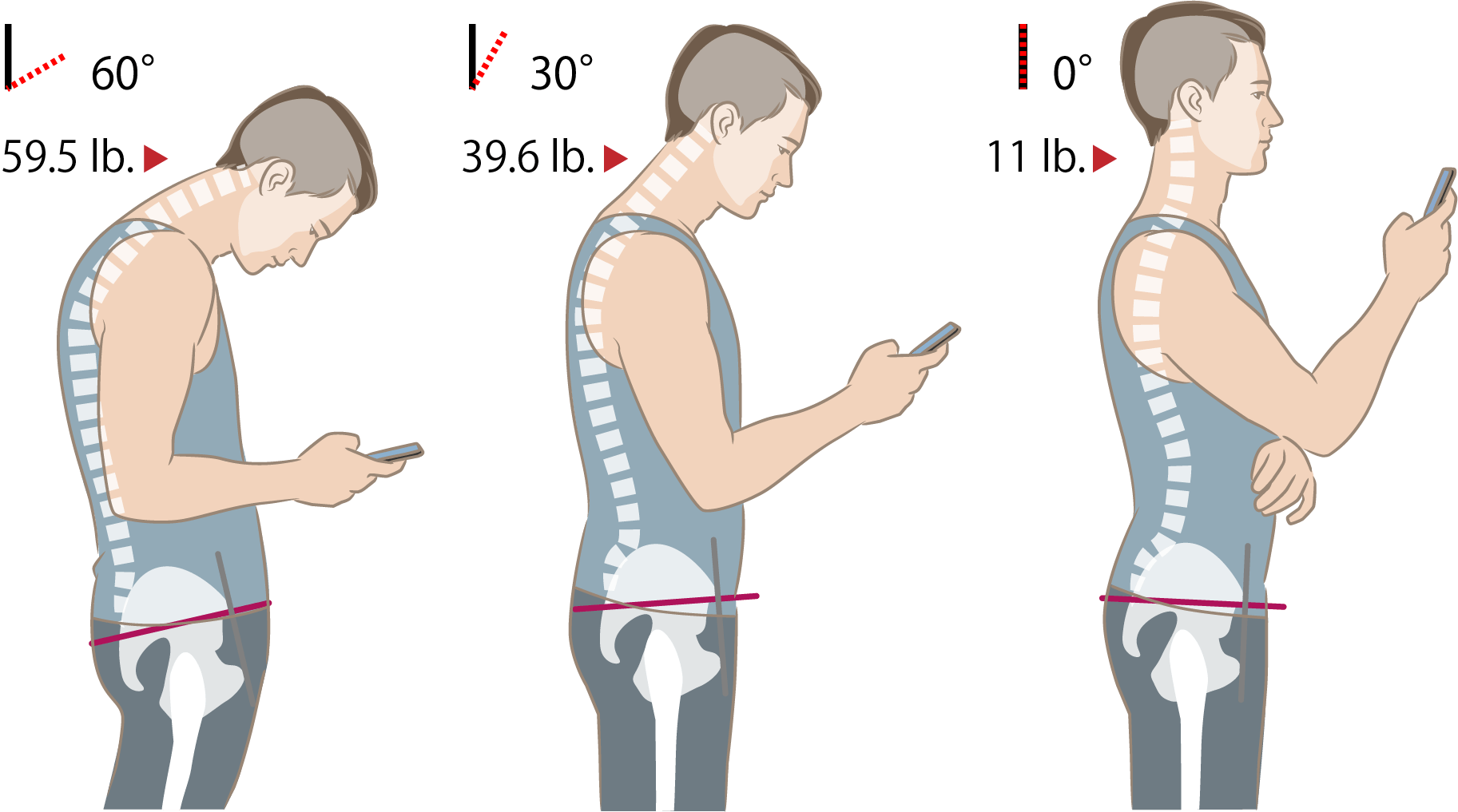 Tech Neck - Strong Posture