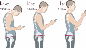 Tech Neck - Strong Posture