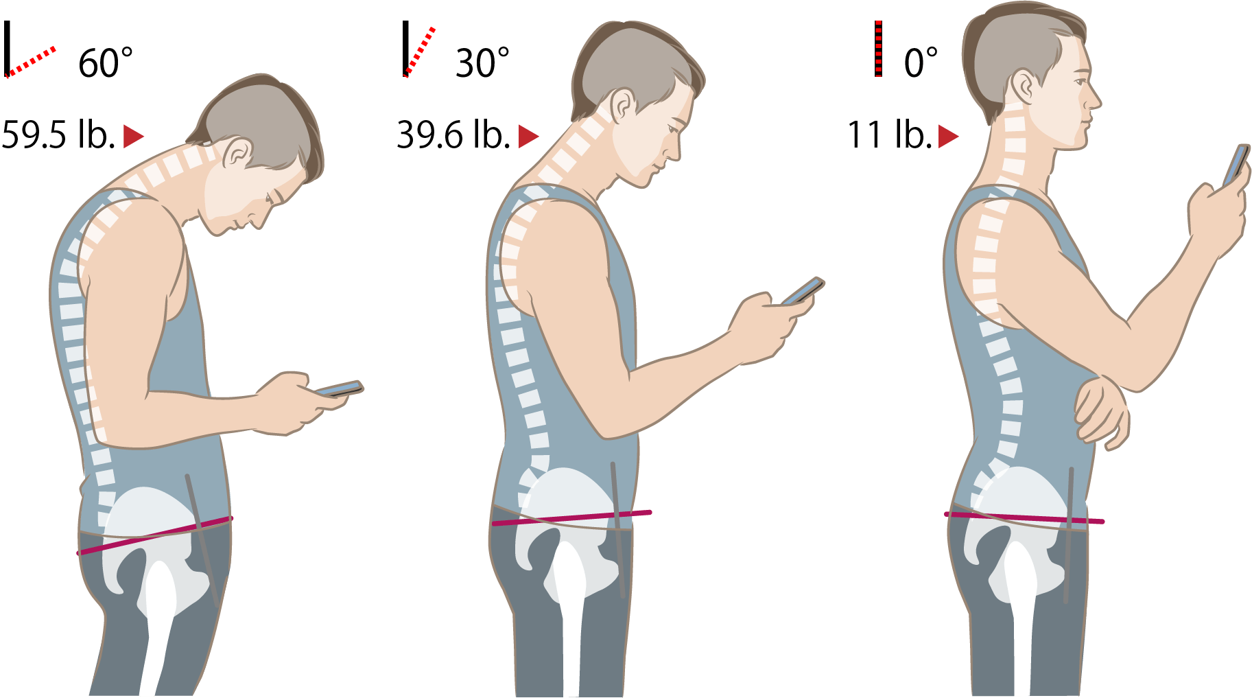 Tech Neck - Strong Posture